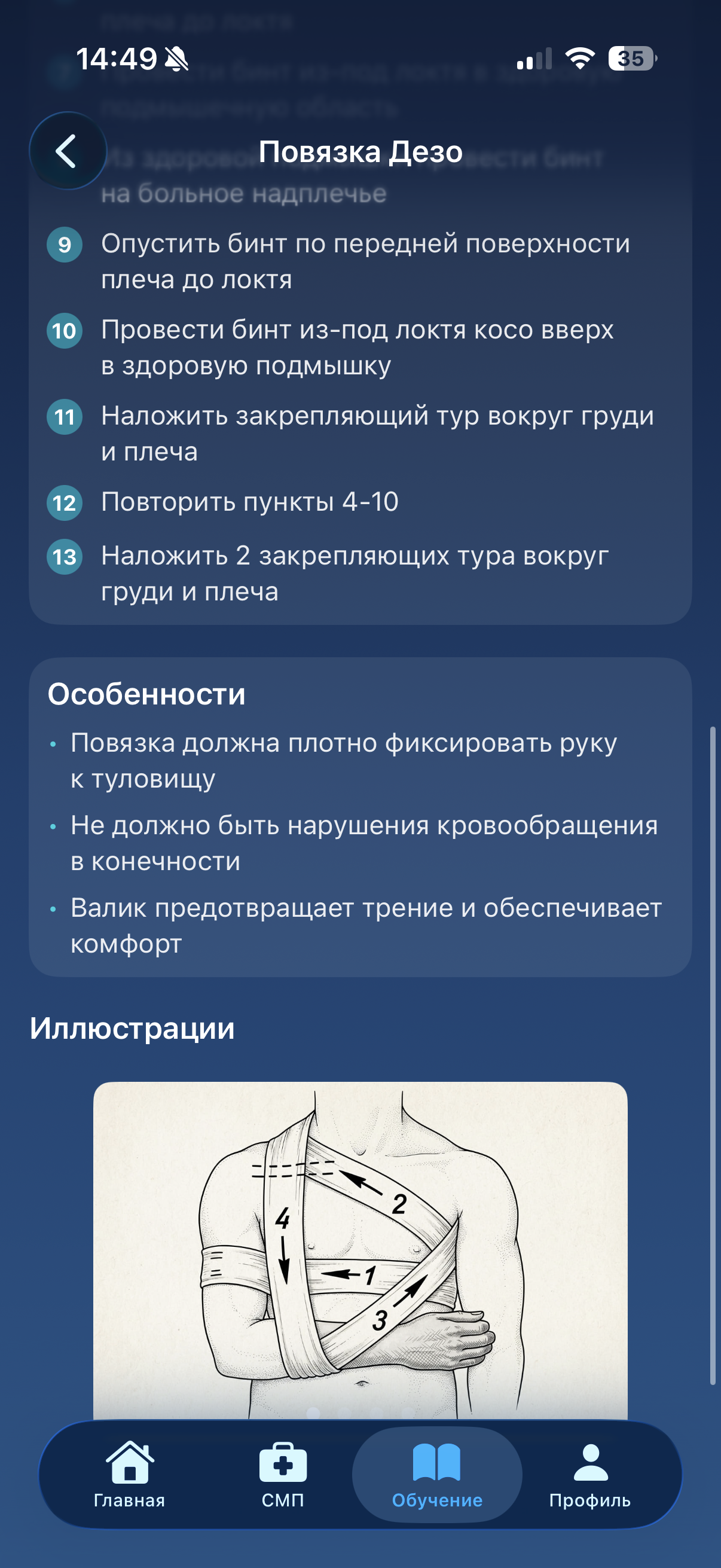 Алгоритм наложения повязки Дезо